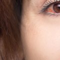 Can an Optometrist Prescribe Medication for Dry Eye?